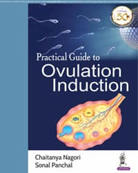 Practical Guide to Ovulation Induction