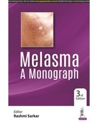 MELASMA A MONOGRAPH