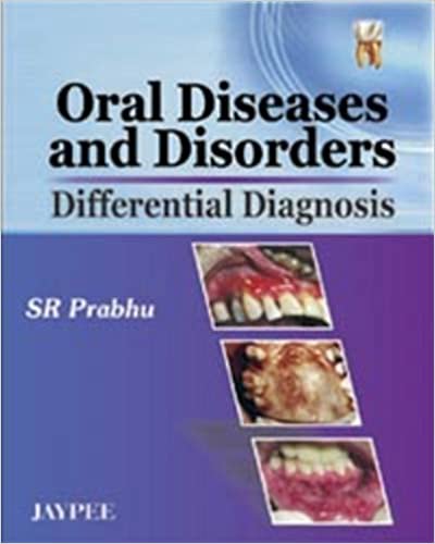 Oral Diseases And Disorders Differential Diagnosis