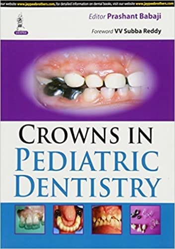 Crowns In Pediatric Dentistry