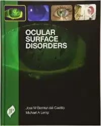 Ocular Surface Disorders