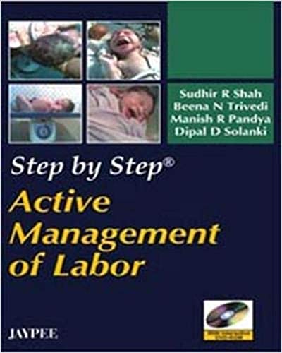 Step by Step Active Management of Labor