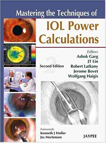 Mastering the Techniques of Intraocular Lens Power Calculations