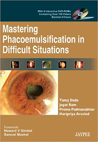 Mastering Phacoemulsification in Difficult Situations (with 4 Interactive DVD-ROMs)