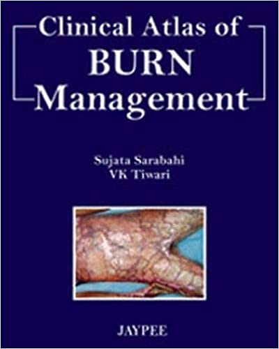 Clinical Atlas of Burn Management