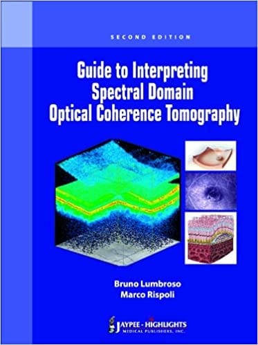 Guide to Interpreting Spectral Domain Optical Coherence Tomography (Paperback)