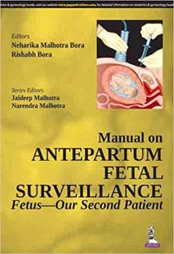 Manual On Antepartum Fetal Surveillance Fetus-Our Second Patient (Paperback)