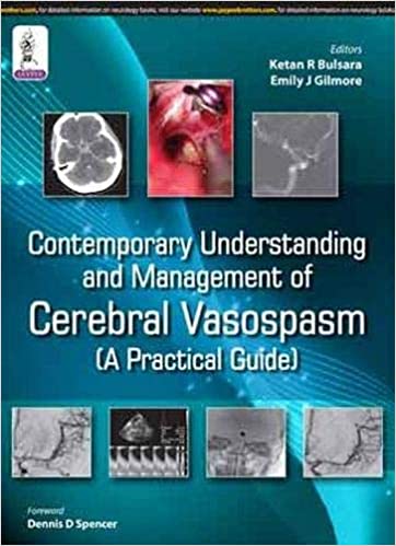 CONTEMPORARY UNDERSTANDING AND MANAGEMENT OF CEREBRAL VASOSPASM (A PRACTICAL GUIDE)