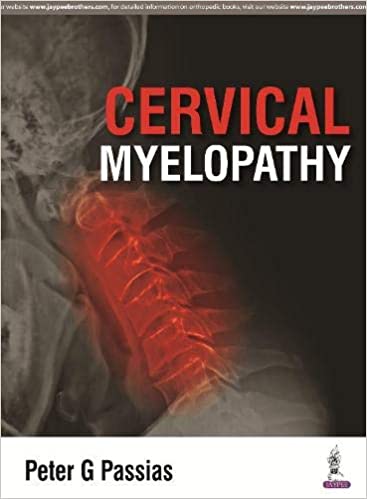 CERVICAL MYELOPATHY