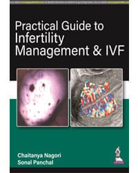 Practical Guide to Infertility Management & IVF