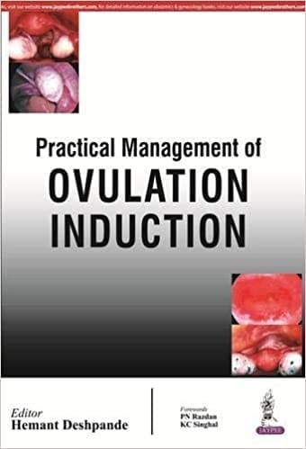 PRACTICAL MANAGEMENT OF OVULATION INDUCTION