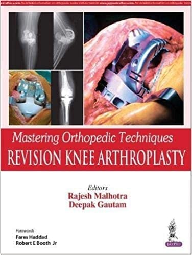 Mastering Orthopedic Techniques:Revision Knee Arthroplasty