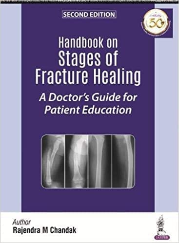 Handbook on Stages of Fracture Healing: A Doctor's Guide for Patient Education