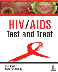 HIV/AIDS-Test and Treat