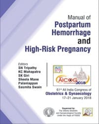 Manual of Postpartum Hemorrhage and High-Risk Pregnancy