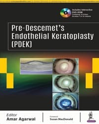 Pre-Descemet?s Endothelial Keratoplasty (PDEK) Includes Interactive DVD-ROM