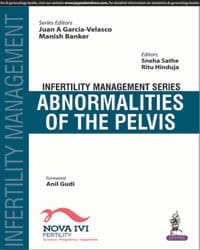 Infertility Management Series: Abnormalities of the Pelvis