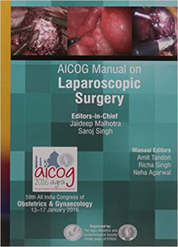 Aicog Manual On Laparoscopic Surgery (Paperback)