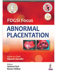 FOGSI FOCUS ABNORMAL PLACENTATION