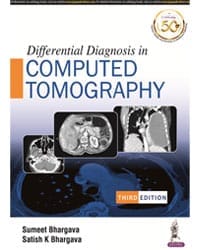 DIFFERENTIAL DIAGNOSIS IN COMPUTED TOMOGRAPHY