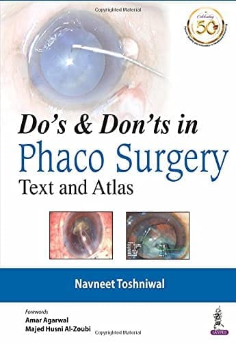 DO?S & DON?TS IN PHACO SURGERY: TEXT AND ATLAS