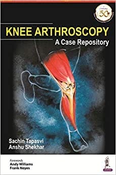 KNEE ARTHROSCOPY: A CASE REPOSITORY