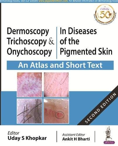 DERMOSCOPY, TRICHOSCOPY & ONYCHOSCOPY IN DISEASES OF THE PIGMENTED SKIN (AN ATLAS AND SHORT TEXT)