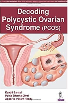 DECODING POLYCYSTIC OVARIAN SYNDROME (PCOS)