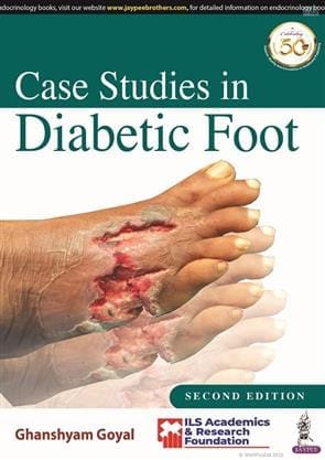 CASE STUDIES IN DIABETIC FOOT