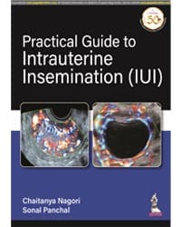 PRACTICAL GUIDE TO INTRAUTERINE INSEMINATION (IUI)