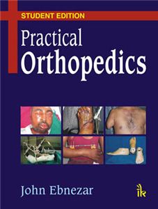 Practical Orthopedics (Student Edition)